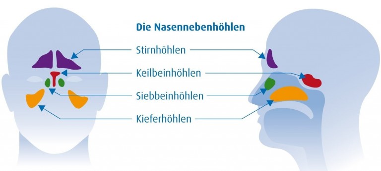 Grafik der Nasennebenhöhlen mit Beschriftung von Stirnhöhlen, Keilbeinhöhlen, Siebbeinhöhlen und Kieferhöhlen