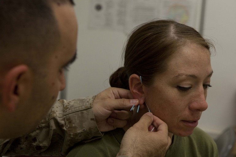 Militärarzt wendet Akupunktur an einer Patientin an